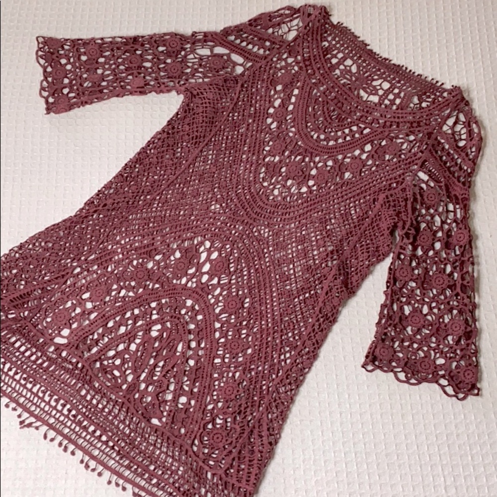 Lacey mid length dress overlay